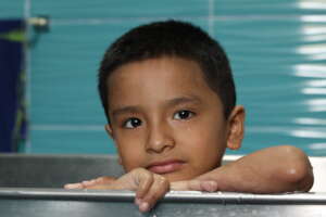 Austin in hydrotherapy