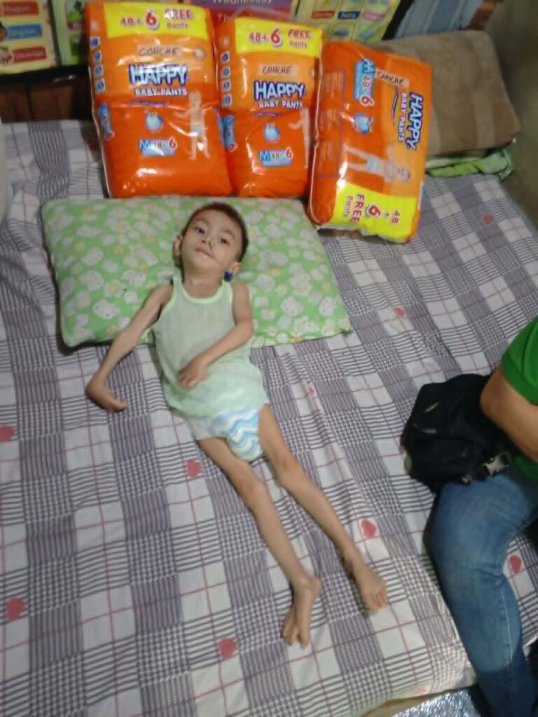 KYLE. 8 year old with cerebral palsy and epilepsy