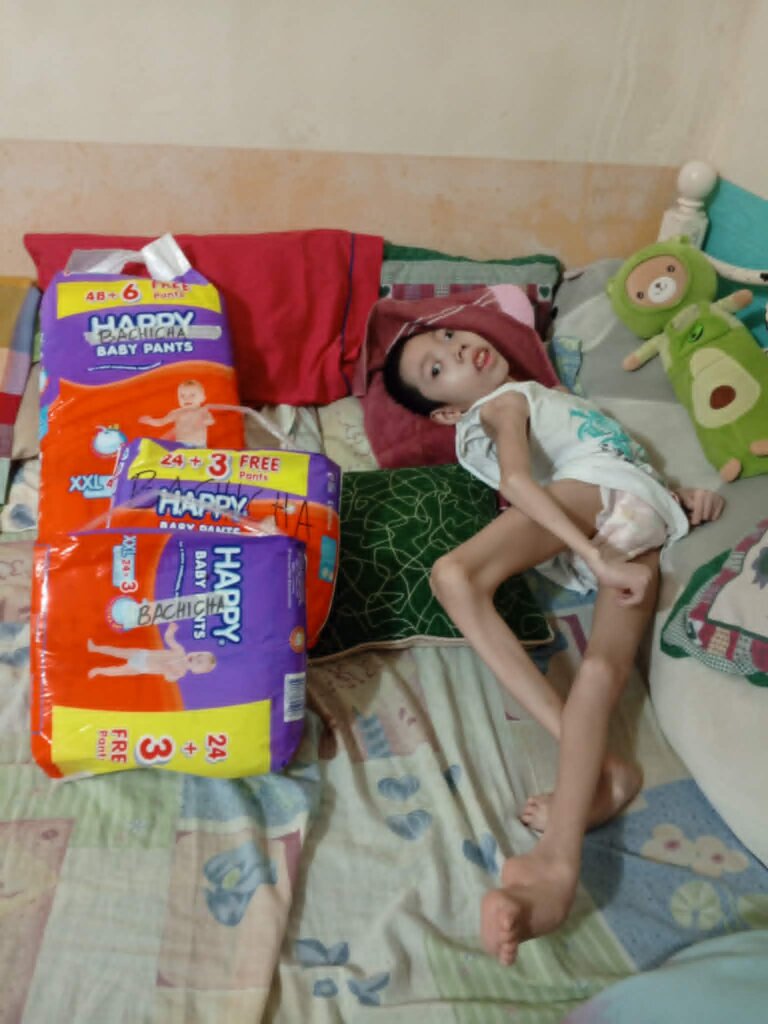 ALDREY , with learning disability and epilepsy