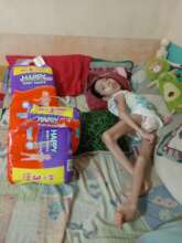 ALDREY , with learning disability and epilepsy