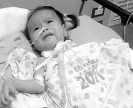 The baby after operation