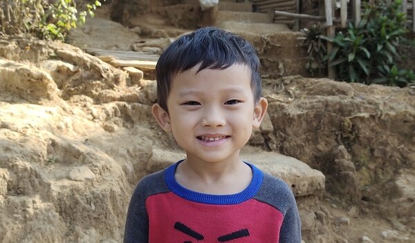 Kan underwent fracture repair surgery.