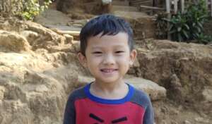 Kan underwent fracture repair surgery.