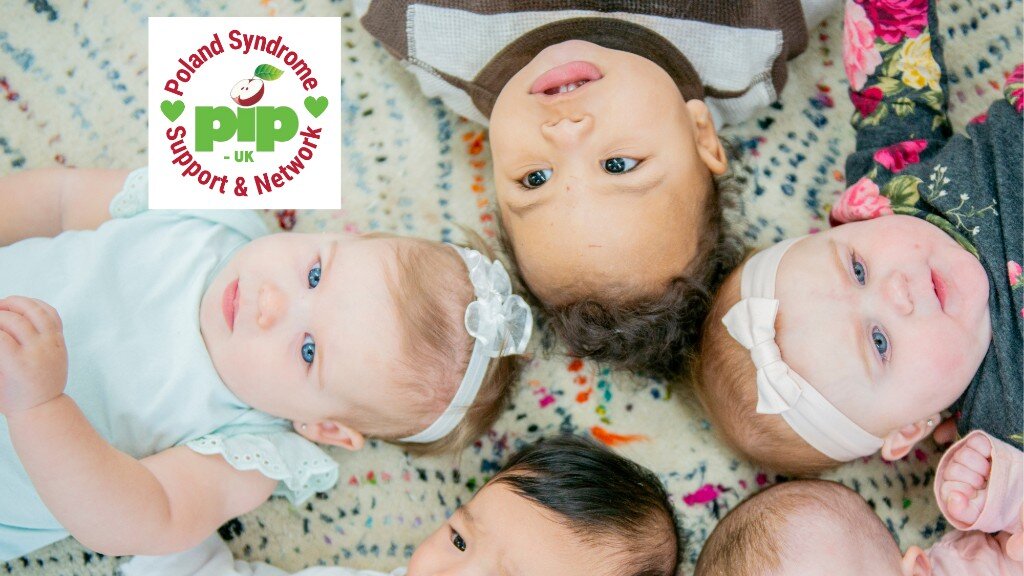 Global Poland Syndrome Community Register Project GlobalGiving