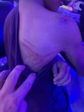 A few of the injuries