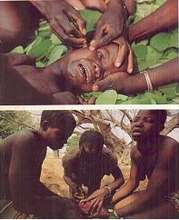 A patient receiving treatment