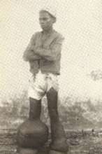 A person suffering from elephantisis
