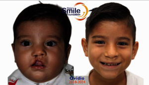Ovidio is growing up with a healthy smile!