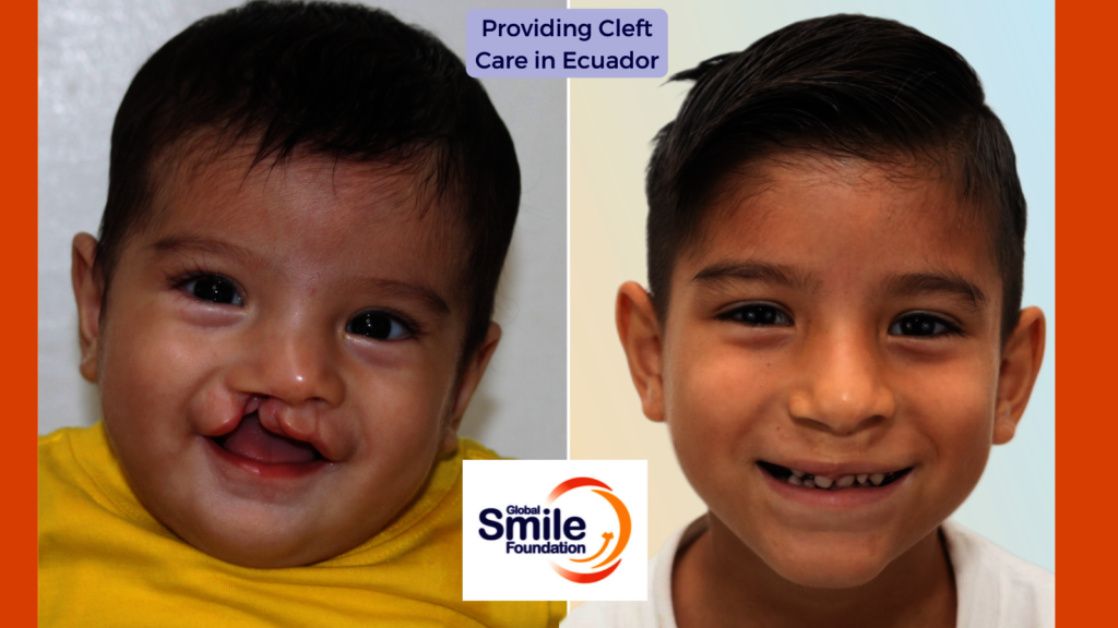 Ovidio's Healthy Smile