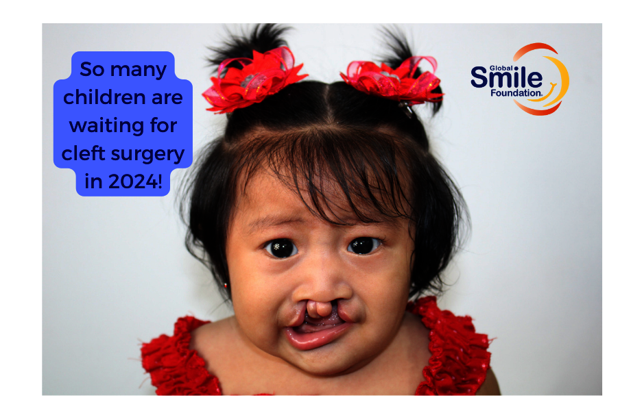 Help Children Born with Cleft in Guayaquil, EC