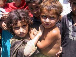 Flood Relief 2010- child with skin disease