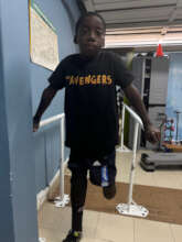 Yonni is ready for his left prosthetic leg