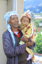 Sitralla after cleft lip surgery with her father