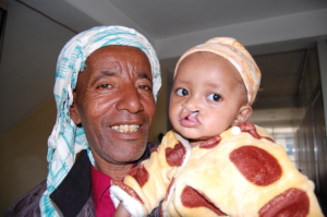 Sitralla before cleft lip surgery with her father.