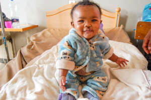 Kenaket after cleft lip surgery