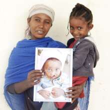 Selam with her mother and before photo