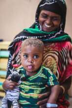 Young boy with cleft and palate