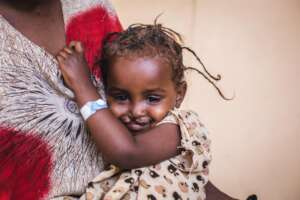 Baby girl with cleft and palate