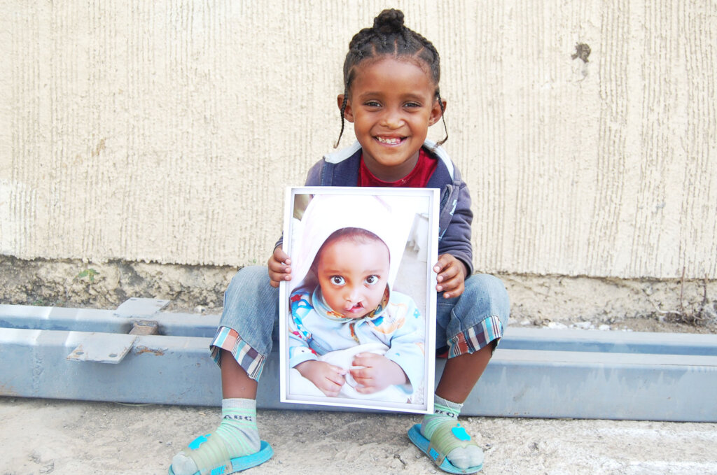 Help a Child Smile, Change a Life