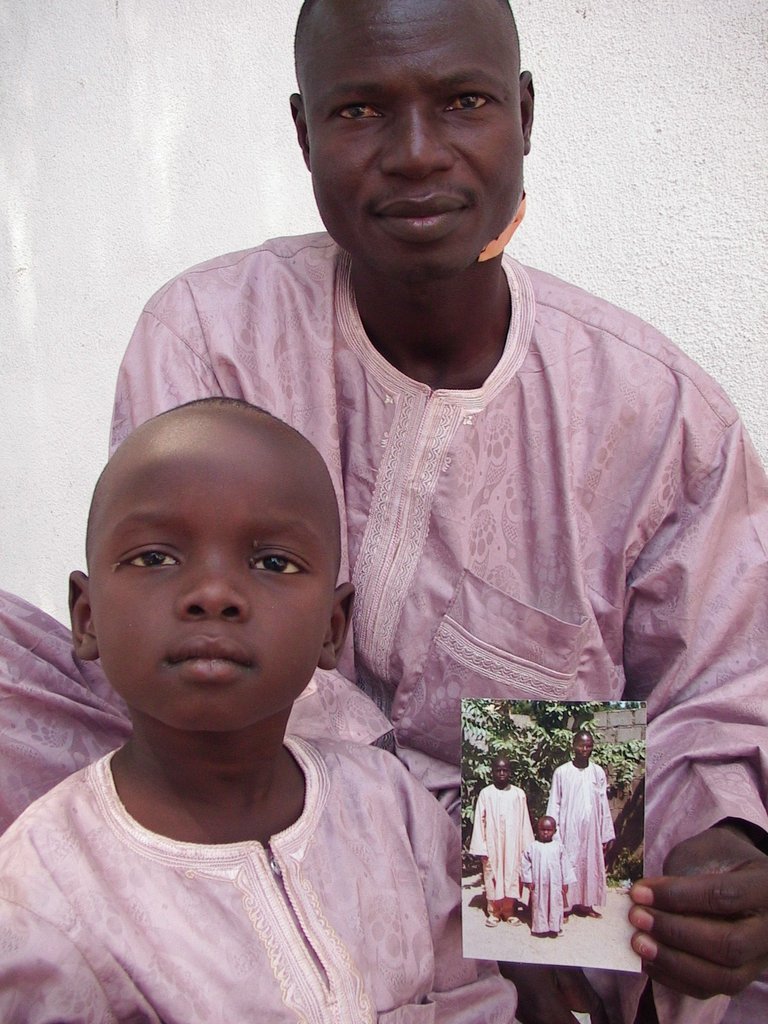 Providing HIV services to 20,000 Cameroonian youth