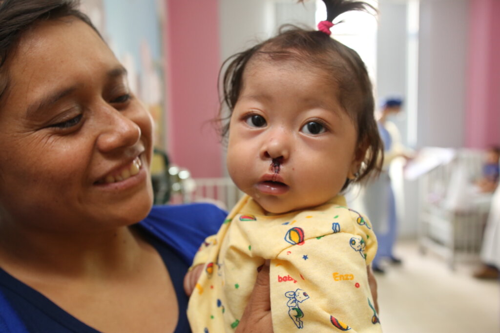 Help 40 children receive cleft surgery in Peru