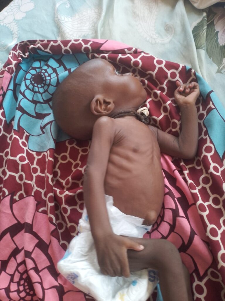 Combat Malnutrition in Nigeria