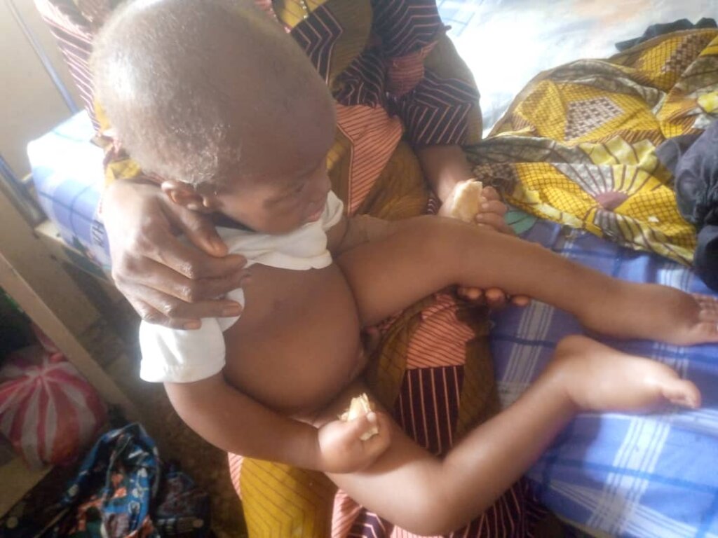 Combat Malnutrition in Nigeria