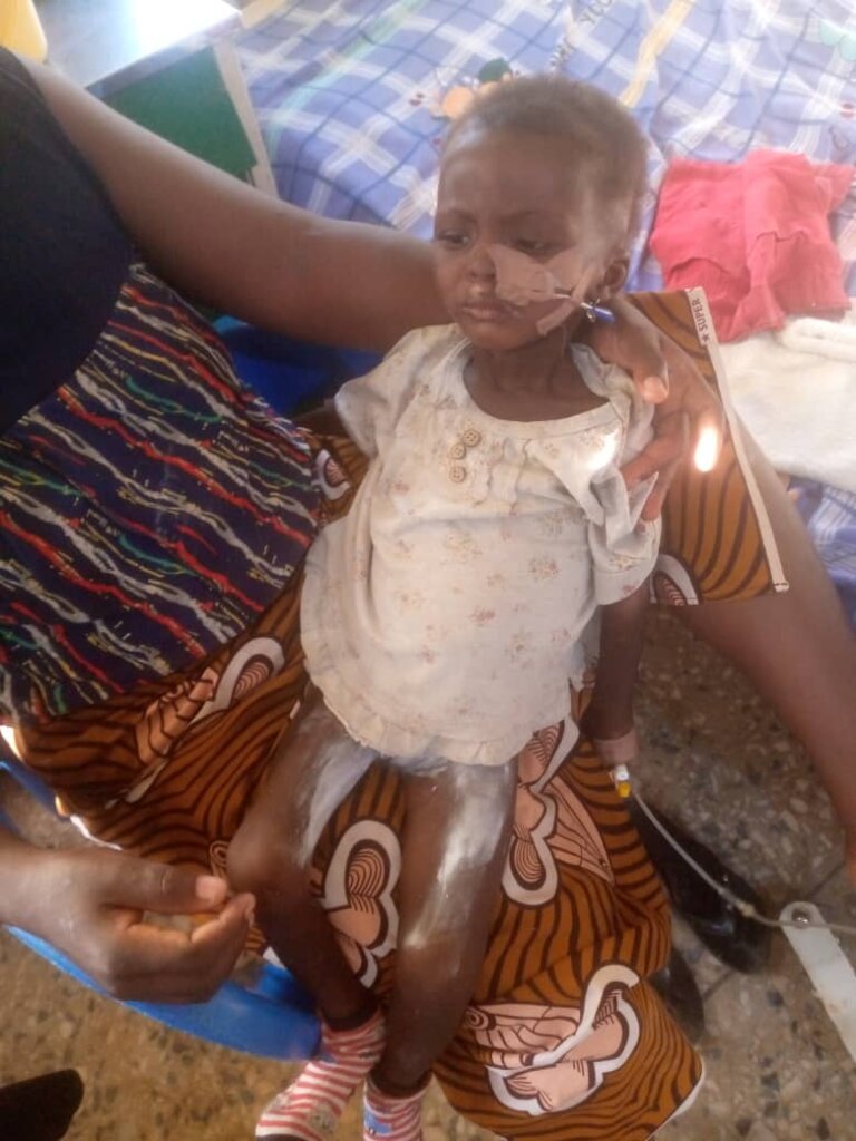 Combat Malnutrition in Nigeria