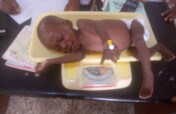 Combat Malnutrition in Nigeria