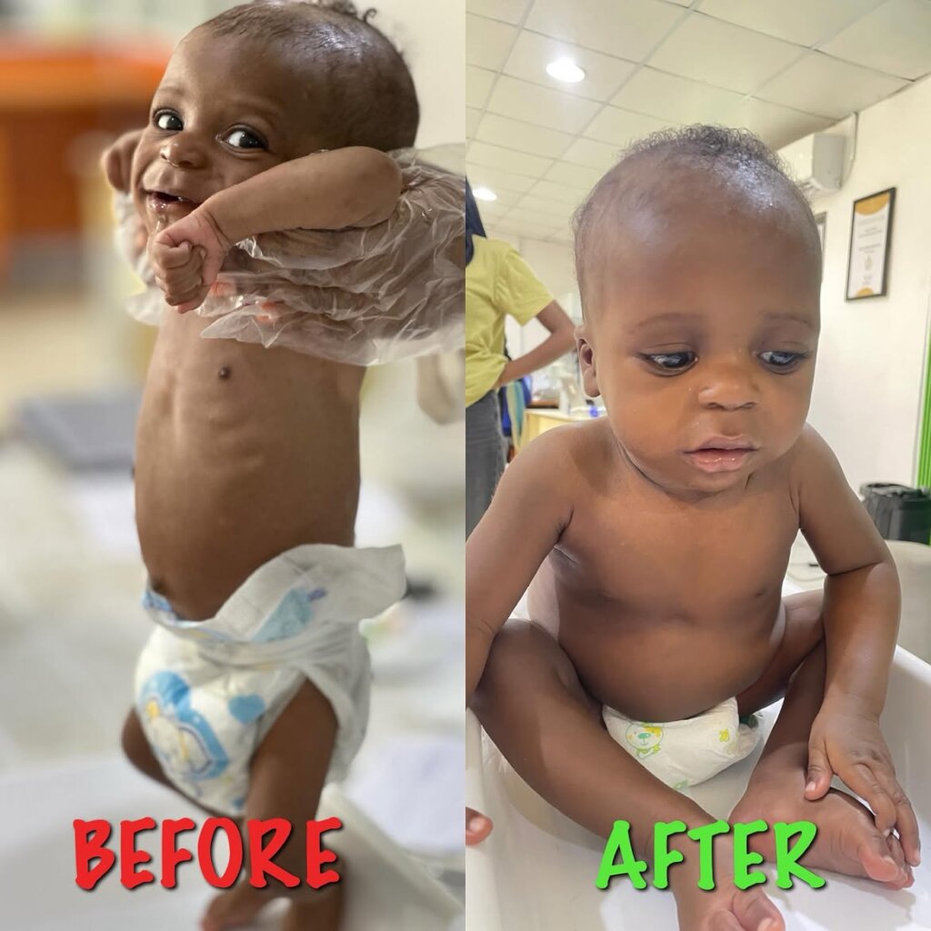 Nourish Vulnerable Mothers and Children in Nigeria