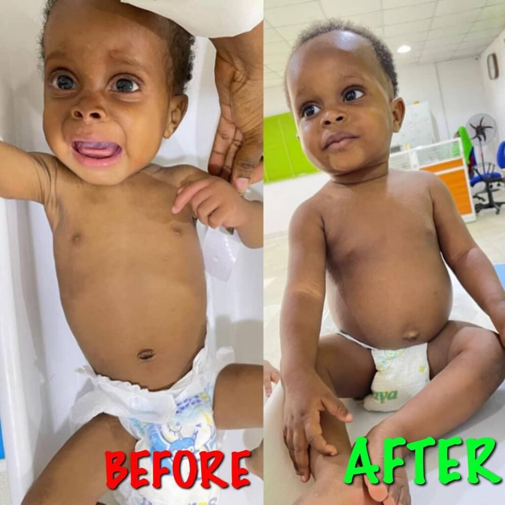 Nourish Vulnerable Mothers and Children in Nigeria