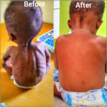 Nourish Vulnerable Mothers and Children in Nigeria