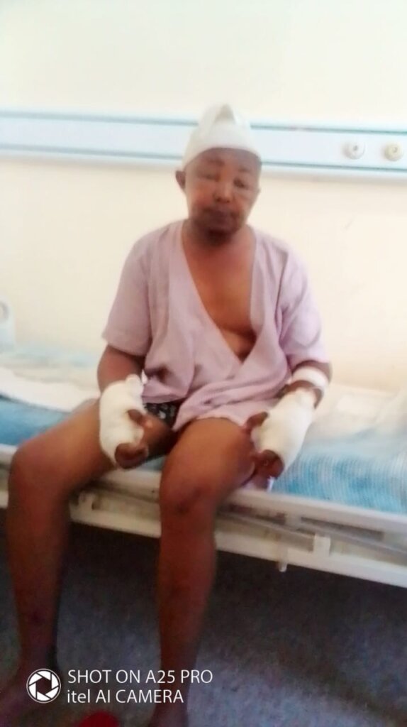 Help George Heal From Accidental Electrocution