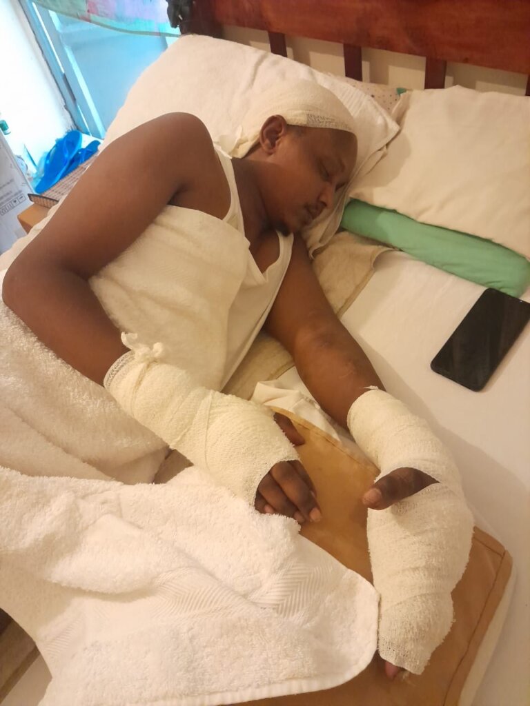 Help George Heal From Accidental Electrocution