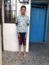 Darlinson before receiving corrective surgery