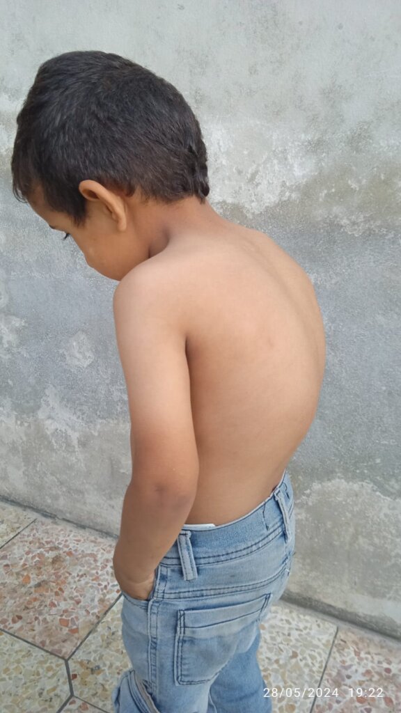 Support Ali to Overcome His Difficulties