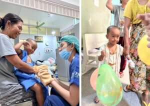 Myo Myo, before and after surgery