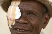 Simple eye surgery to restore sight to Ethiopians