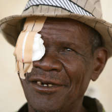 Simple eye surgery to restore sight to Ethiopians