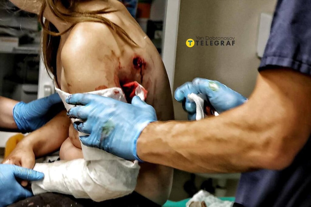 Aid to Ukrainian Hospital Ohmatdyt after Shelling