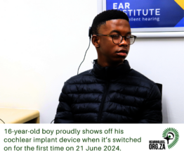 Showing off Cochlear Implant device