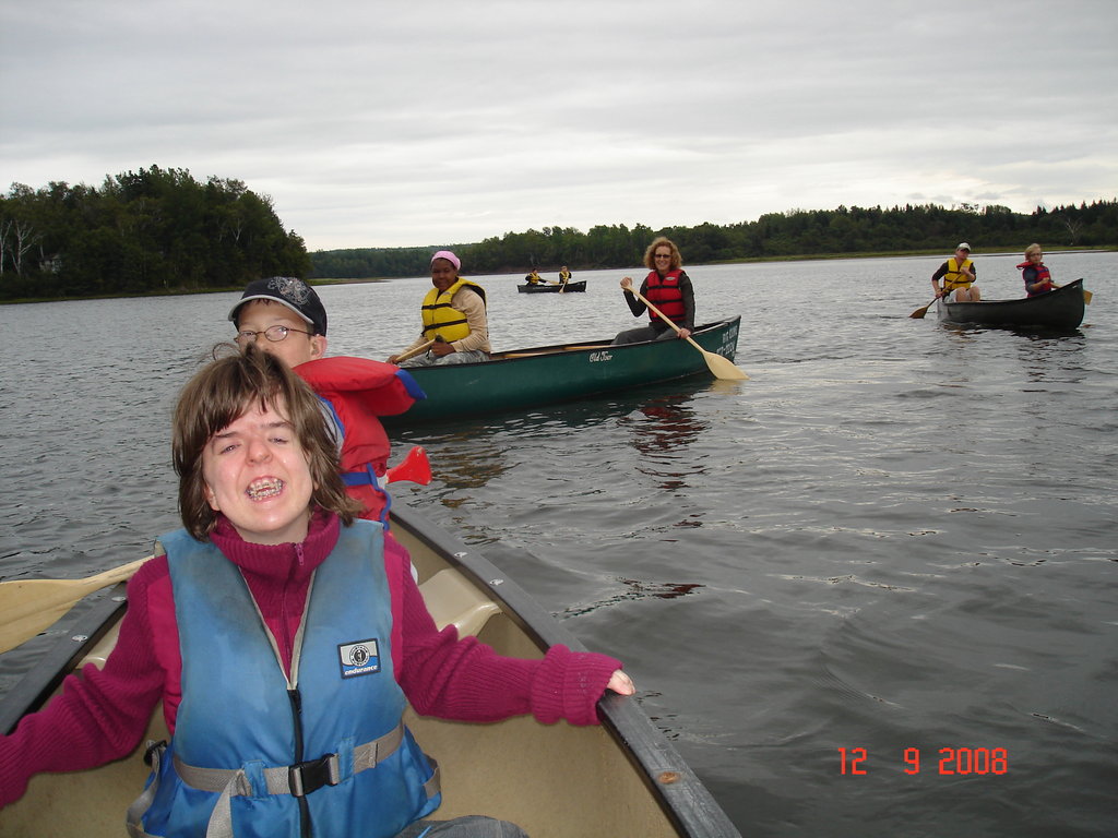 Help kids with facial differences become leaders