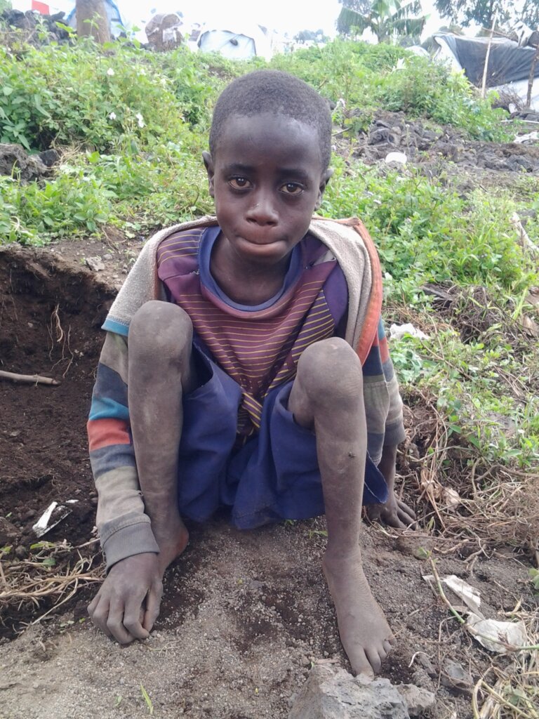 Mobility assistance for disabled children in DRC