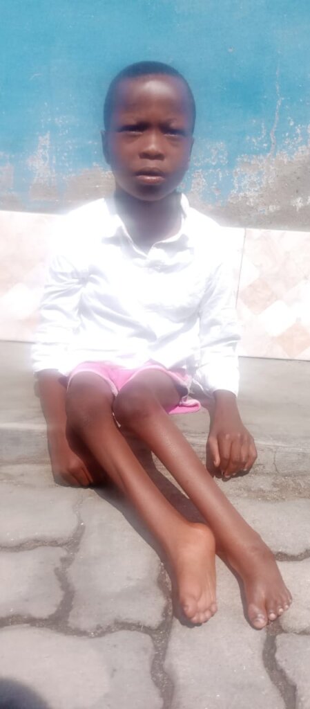Mobility assistance for disabled children in DRC