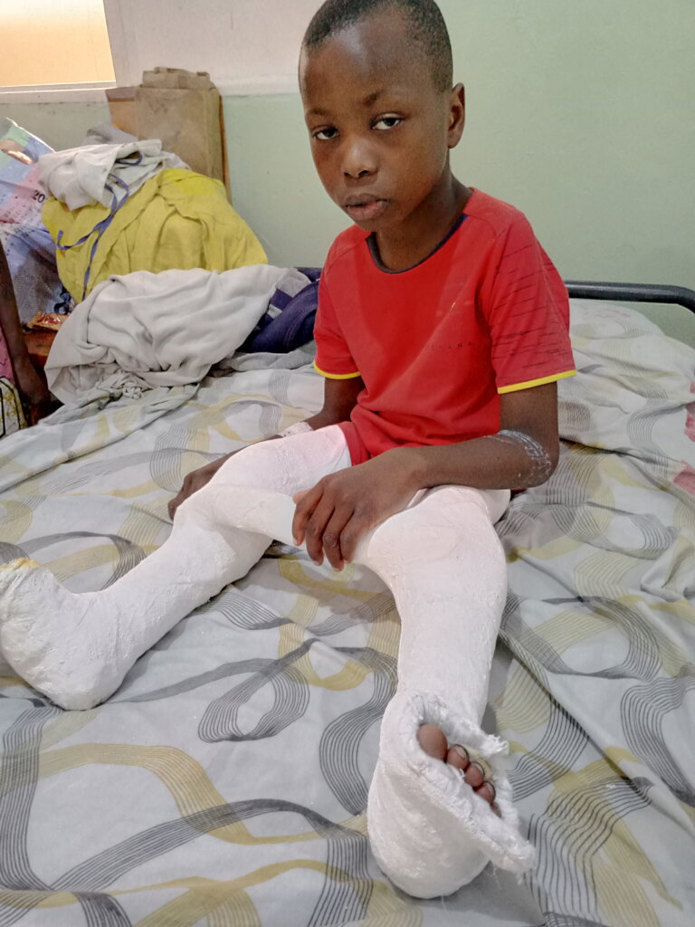 Mobility assistance for disabled children in DRC