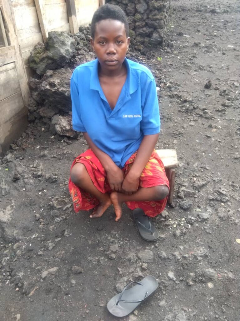 Mobility assistance for disabled children in DRC