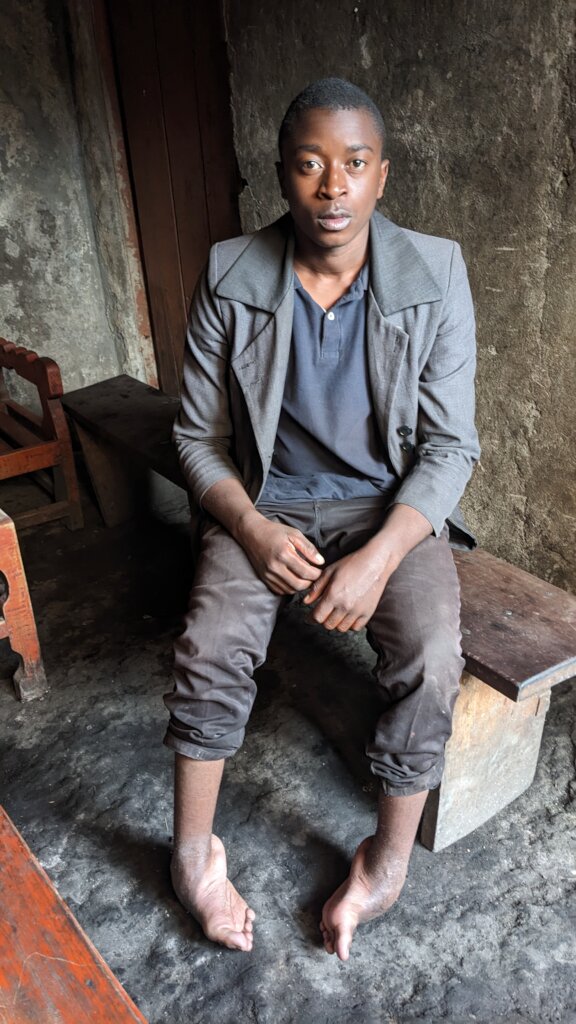 Mobility assistance for disabled children in DRC