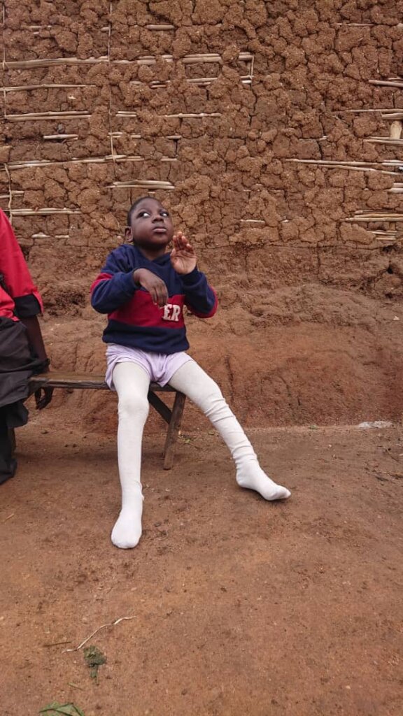 Mobility assistance for disabled children in DRC