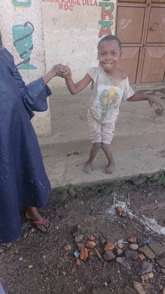 Mobility assistance for disabled children in DRC