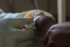 A displaced child receiving care at the Clinic.